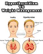 Why Does Hyperthyroidism Cause Weight Loss?