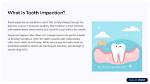 Why Does Impaction Occur?