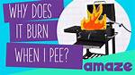 Why Does It Burn When I Pee and After I Pee?
