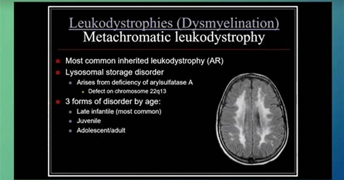 Why Does Leukodystrophy Occur?
