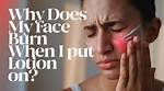 Why Does Liniment Burn?