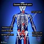 Why Does My Backbone Hurt?