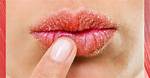 Why Does My Lips Dry?