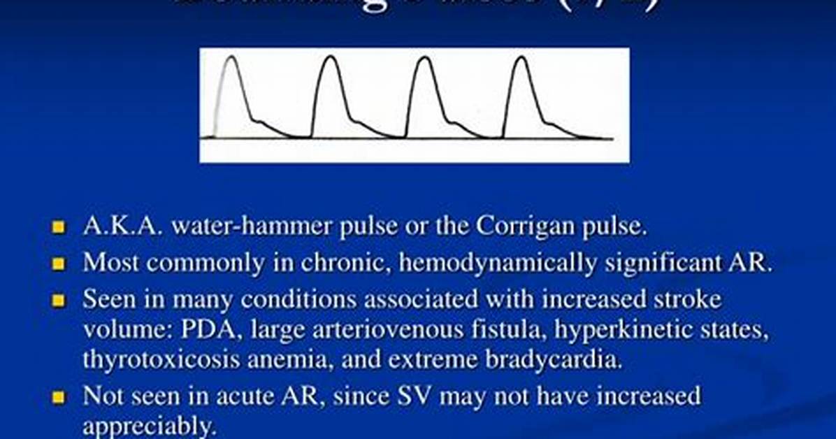 Why Does Pda Cause Bounding Pulse?