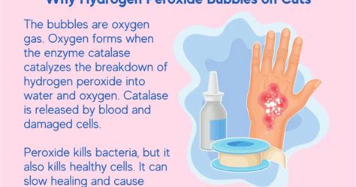 Why Does Peroxide Bubble?