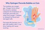 Why Does Peroxide Bubble?