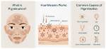 Why Does Pigmentation Occur?