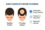 Why Does Self-Thinning Occur?
