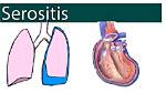 Why Does Serositis Occur?