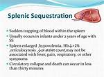 Why Does Splenic Sequestration Occur?