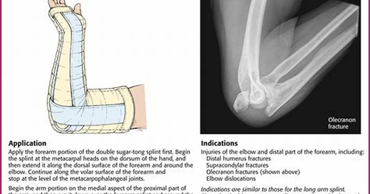 Why Does Splint Reignite?
