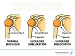 Why Does Subluxation Occur?