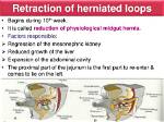 Why Does the Midgut Herniation?