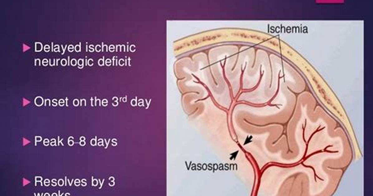 Why Does Vasospasm Occur?