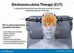 Why Ect Is Given?