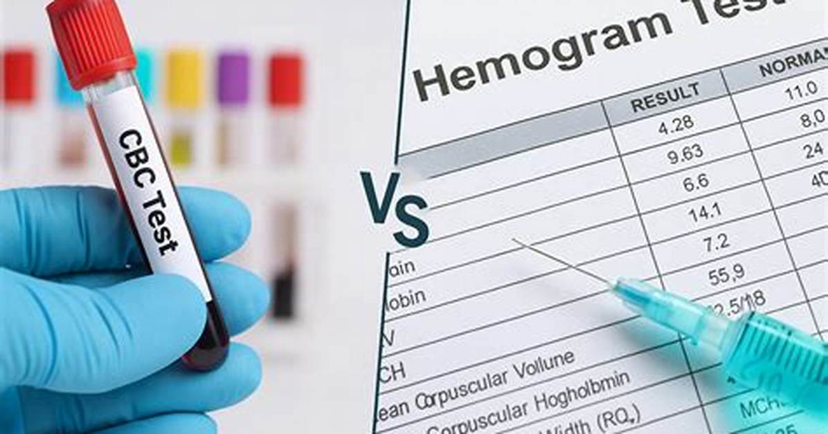 Why Hemogram Test Is Done?