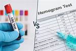 Why Hemogram Test Is Done?