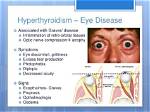 Why Hyperthyroidism Cause Exophthalmos?