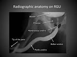 Why Is a Urethrogram Done?