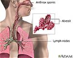Why Is Inhalation Anthrax Lethal?