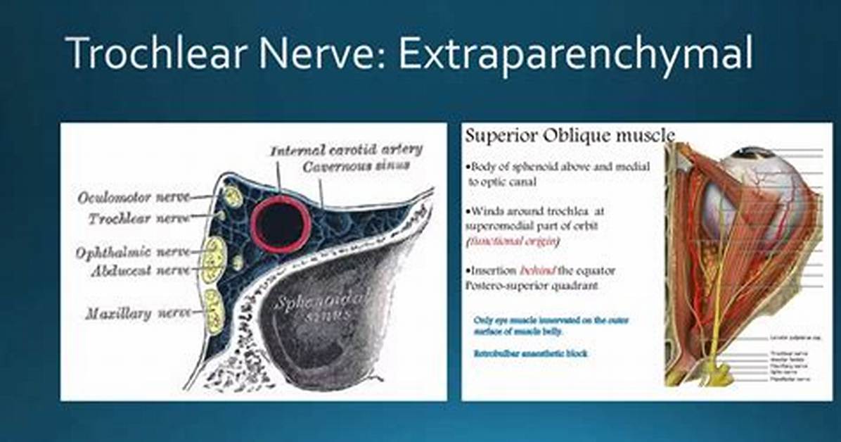 Why Is It Called Trochlear Nerve?