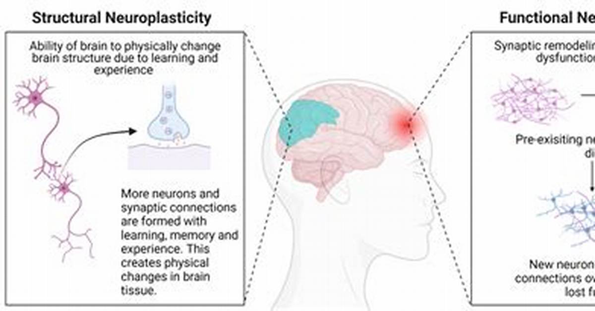 Why Is Structural Plasticity?