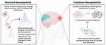 Why Is Structural Plasticity?