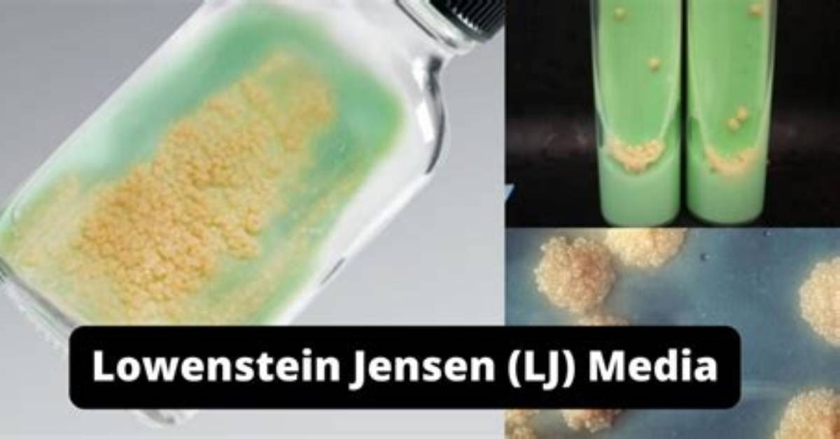 Why Lowenstein Jensen Medium?