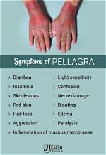 Why Maize Causes Pellagra?