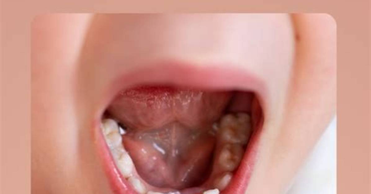 Why Milk Tooth Fall?