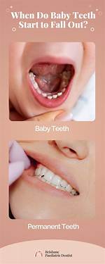 Why Milk Tooth Fall?