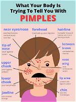 Why Pimples on Back?