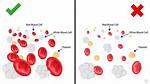 Why Red Blood Cells Decrease?