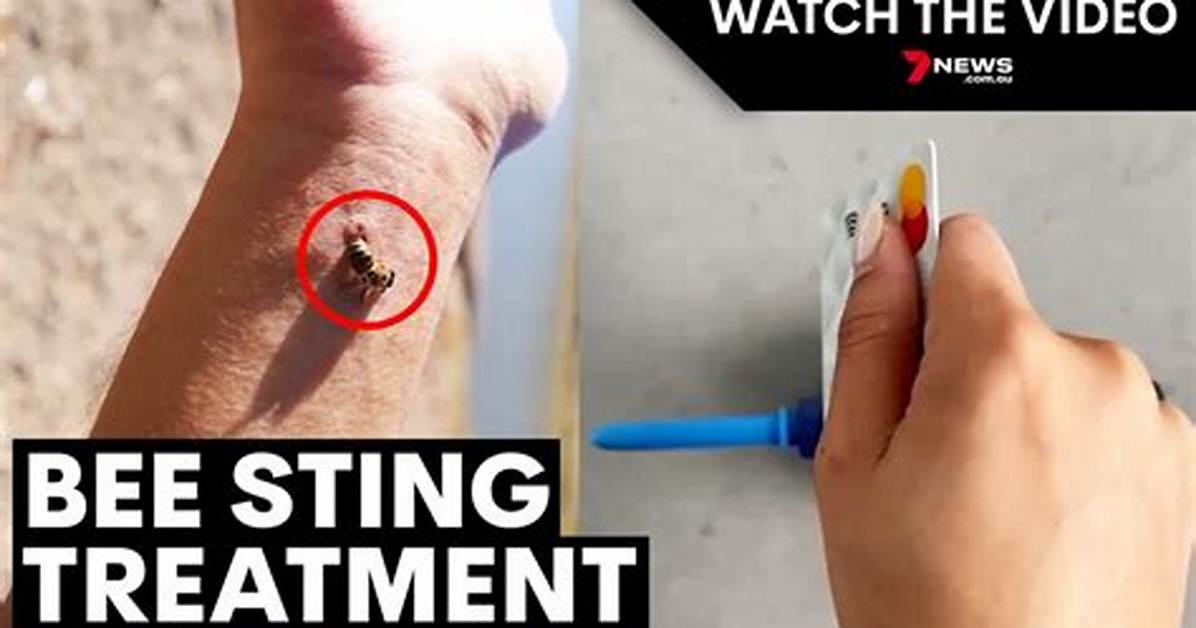 Why Remove Bee Stinger?