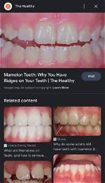 Why Ridges on Teeth?
