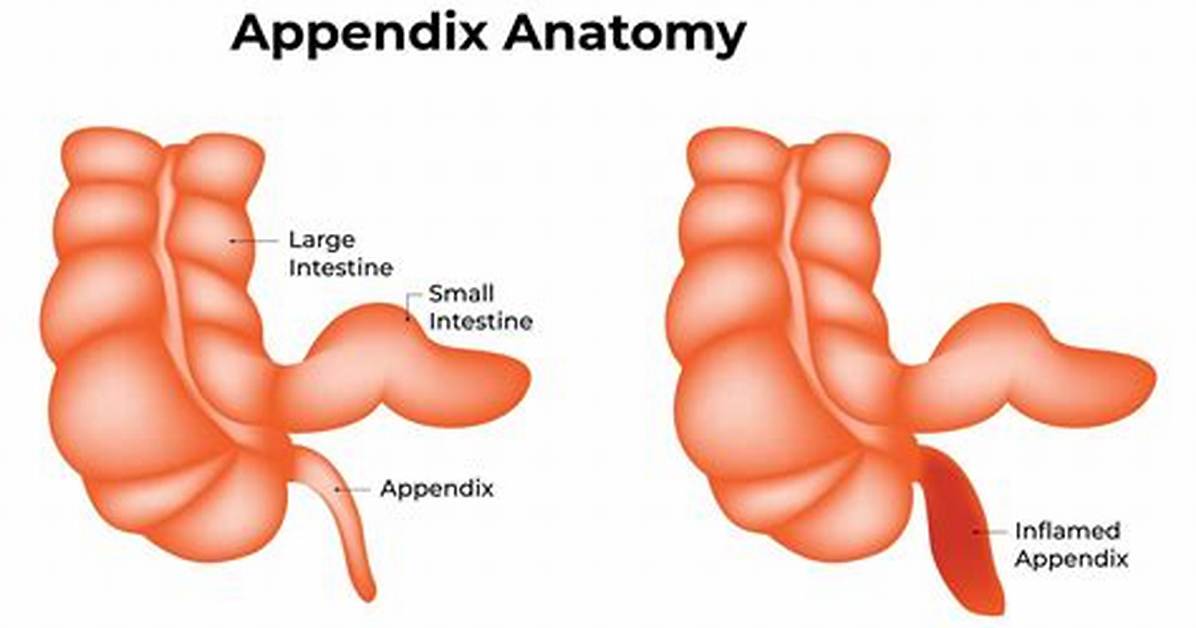 Why Side Is Your Appendix on?
