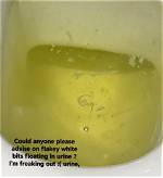 Why Specks in Pee?