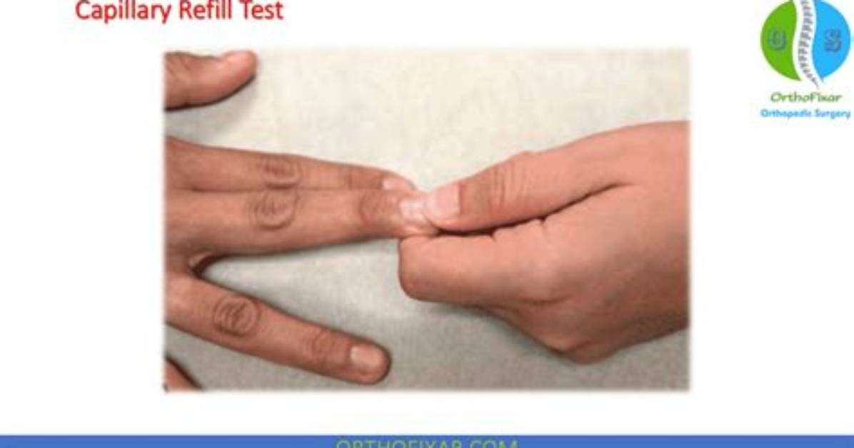 Why Test Capillary Refill?