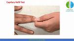 Why Test Capillary Refill?