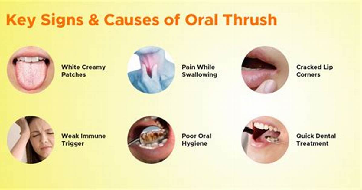 Why Thrush Keeps Coming Back?