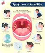 Why Tonsillitis Keeps Coming Back?