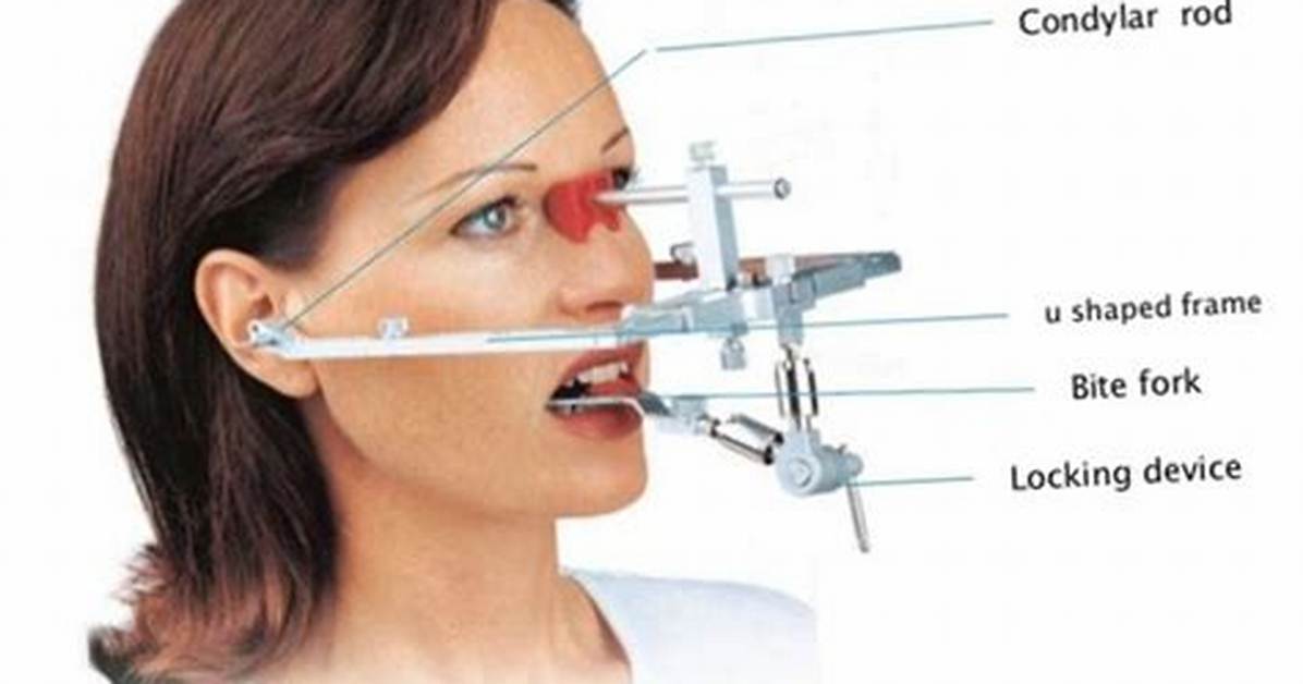 Why Use a Facebow?