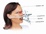 Why Use a Facebow?