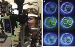 Why Use Applanation Tonometry?