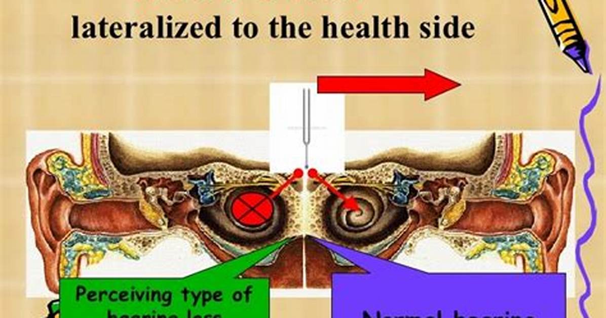 Why Weber Test Lateralization?