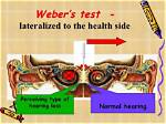 Why Weber Test Lateralization?