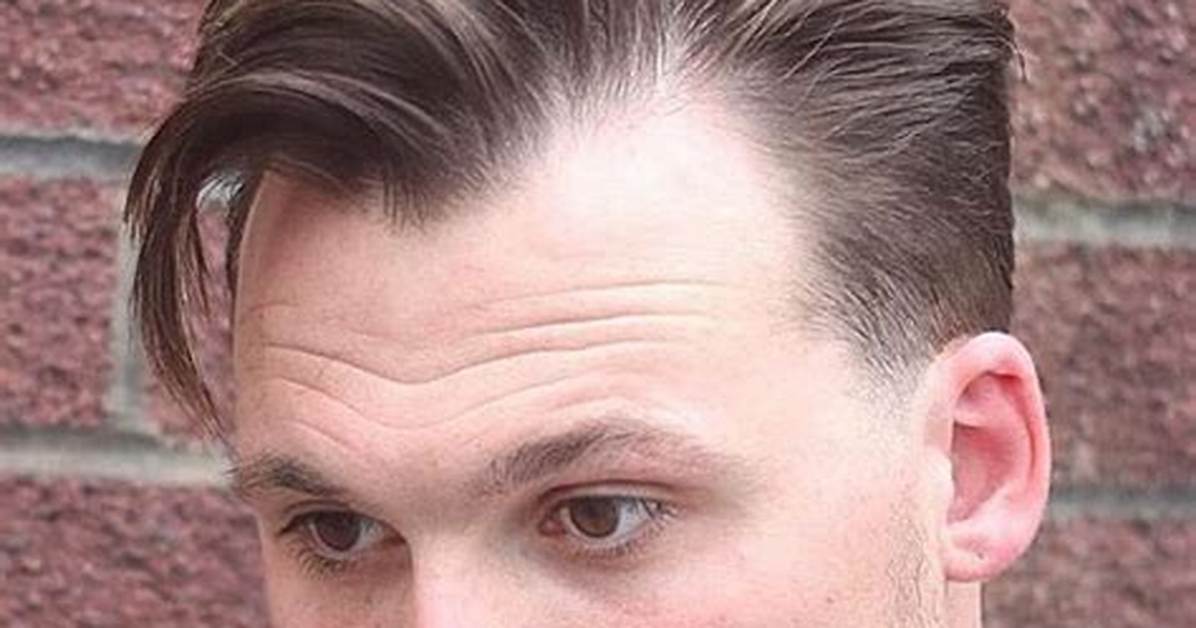 Widows Peak Men