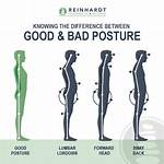 Will a Chiropractor Help with Posture?