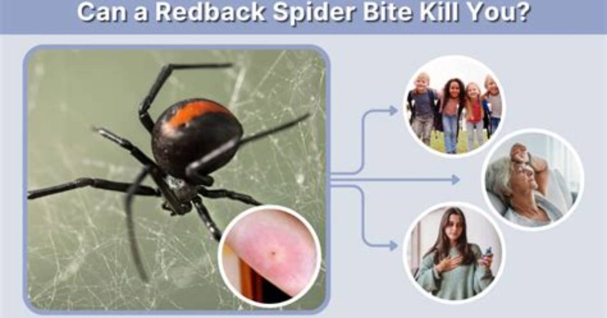 Will a Redback Bite Kill You?