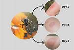 Will a Spider Bite Multiple Times?